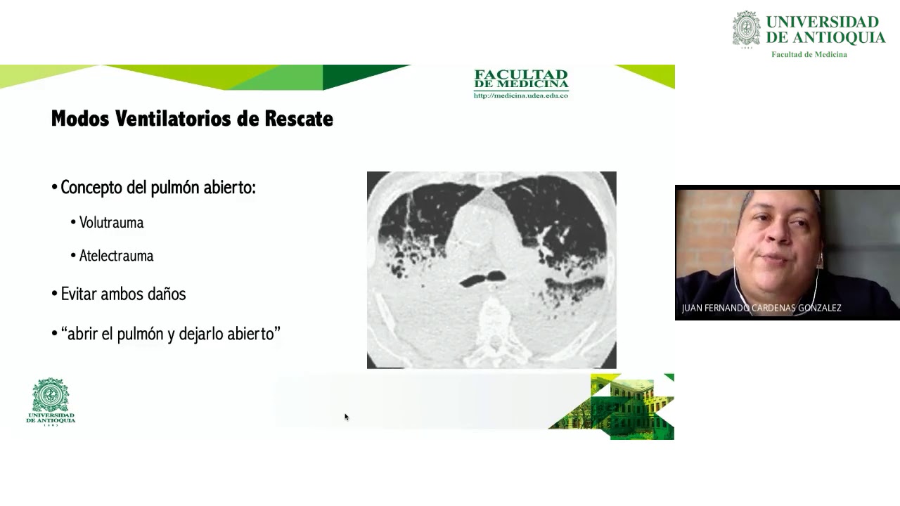 Club del Libro: Modos Alternativos de Ventilación Mecánica - Dr. Juan Fernando Cárdenas