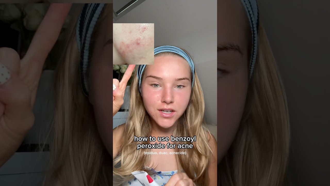 how to use BENZOYL peroxide for CLEAR SKIN!😍 