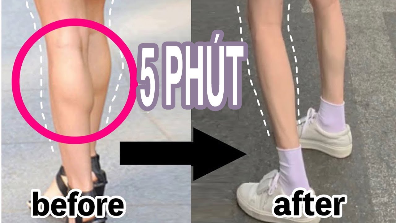 Cách Người Nhật Giảm Mỡ Bắp Chân | Đơn Giản | Hiệu Quả | Giúp Chân Thon Gọn
