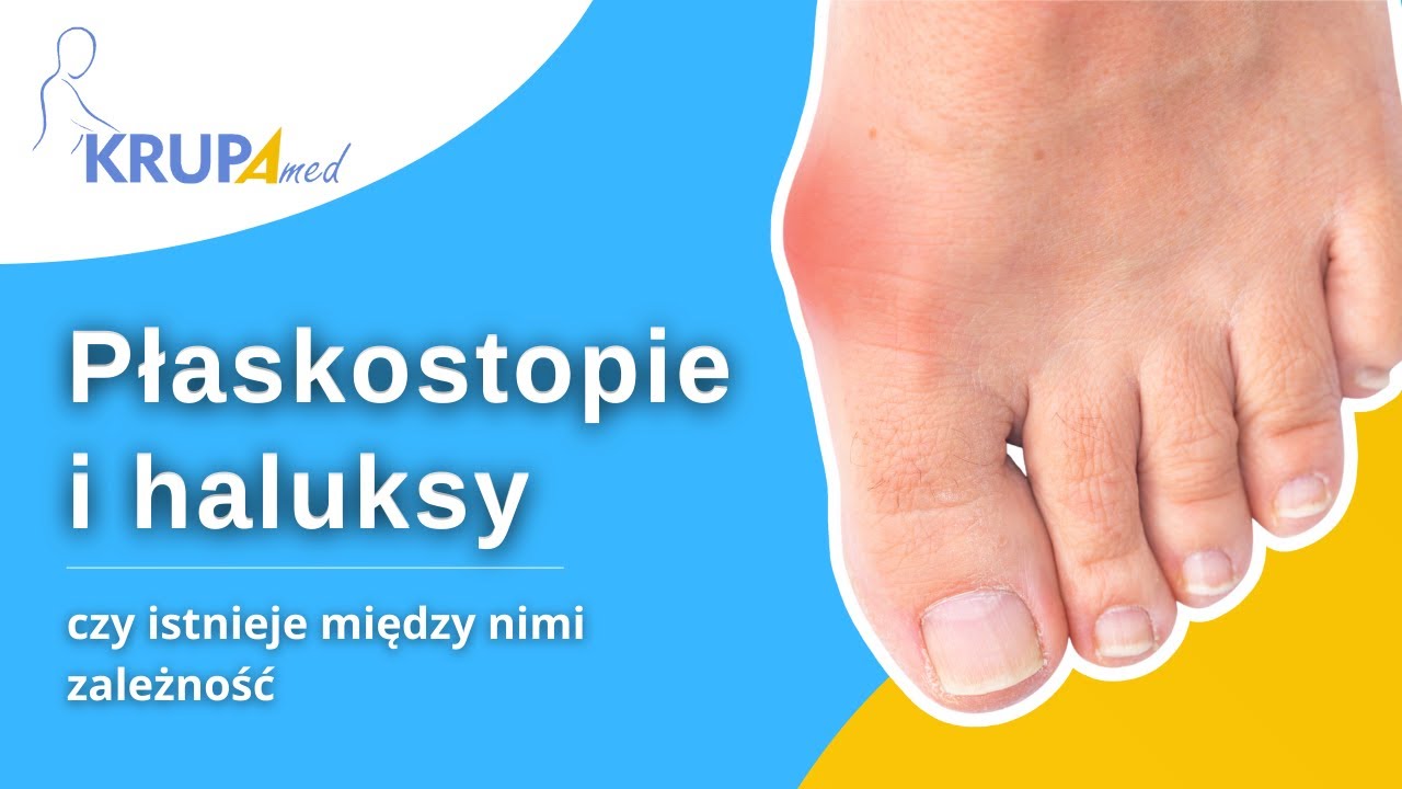 Płaskostopie i haluksy &ndash; czy istnieje między nimi zależność❓