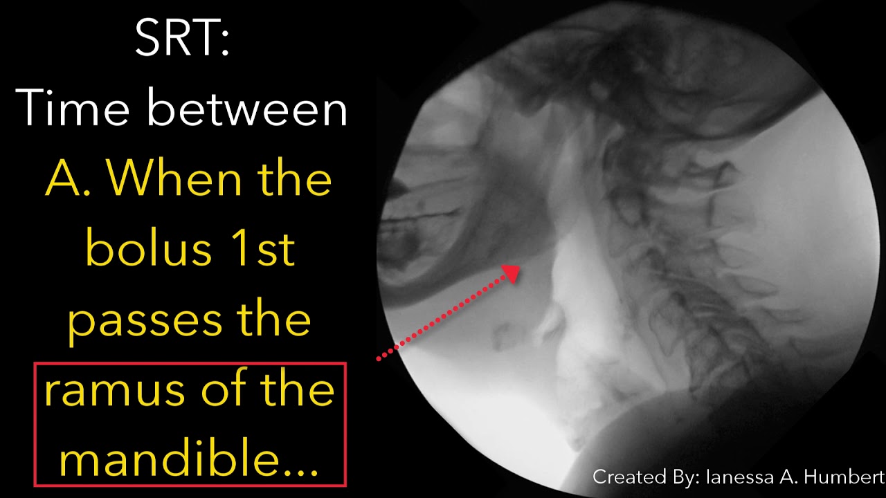 Thin liquid... high performance bolus