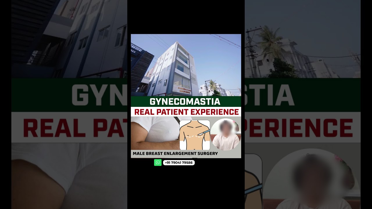 Gynecomastia Surgery Review 💉 | Real Patient Experience 👨&zwj;⚕️✨