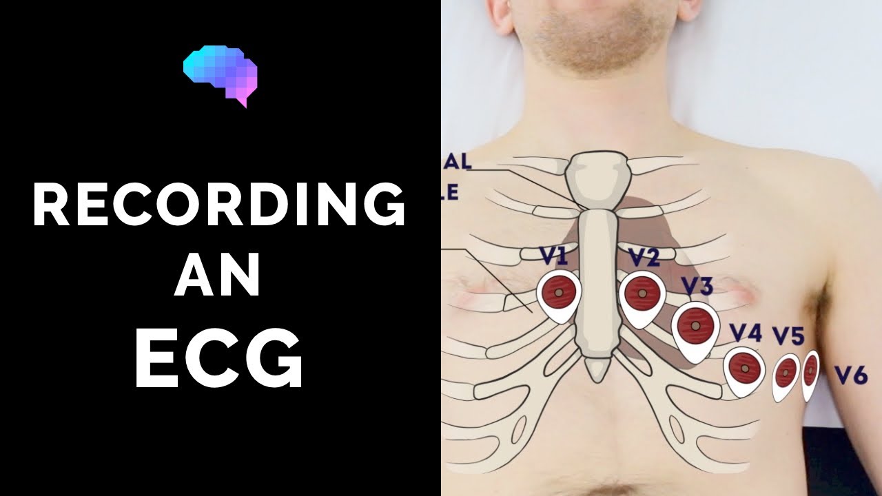 How to record an ECG - OSCE Guide | UKMLA | CPSA | PLAB 2