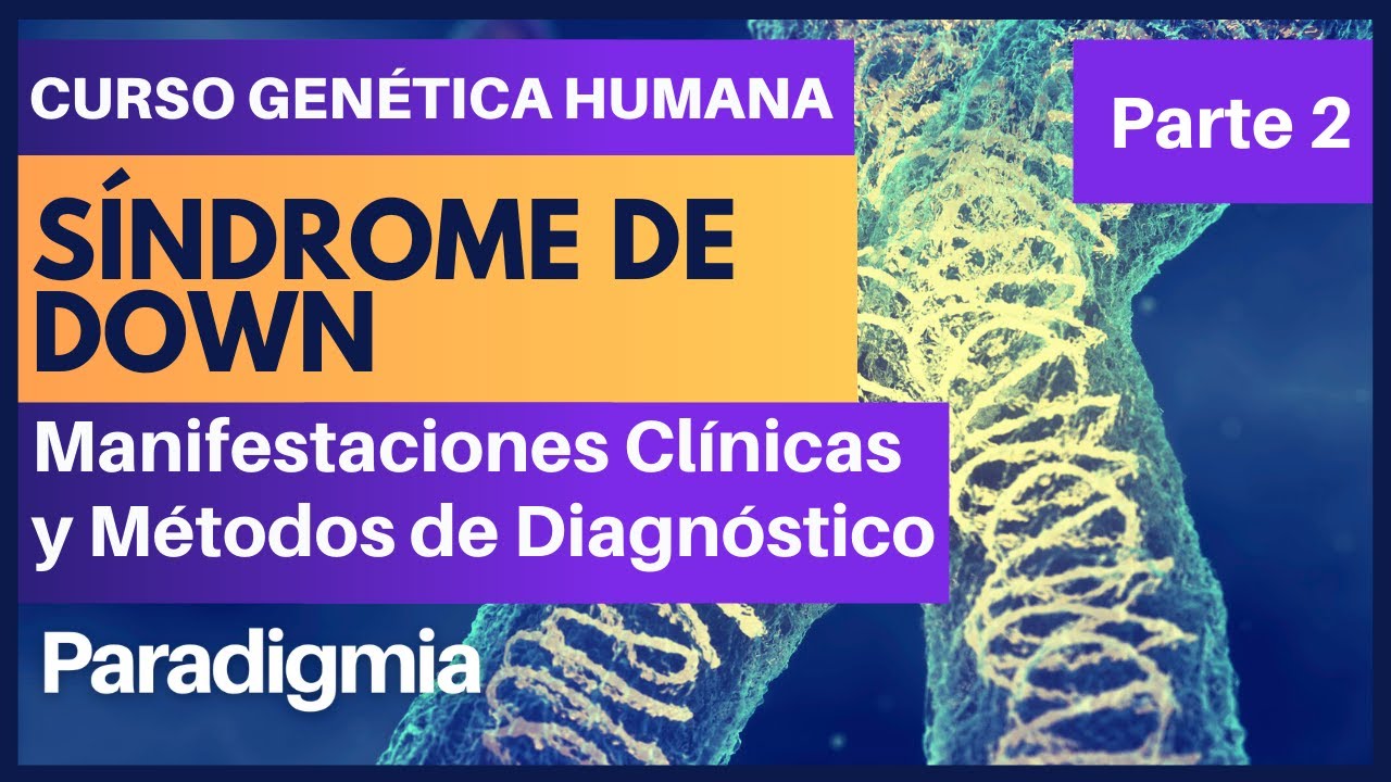 Sindrome de Down 🧬 Explicación de las Manifestaciones Clínicas y los Métodos de Diagnóstico ✅