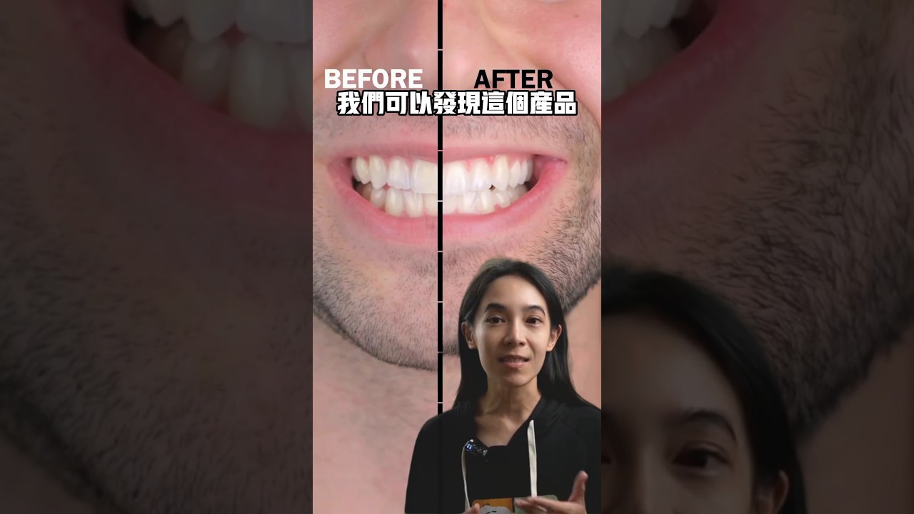 Crest美白牙貼到底有沒有效，牙醫師實測，無業配#牙齒美白