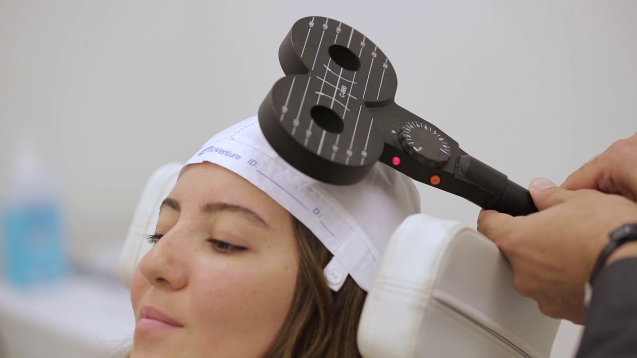 Transcranial Magnetic Stimulation