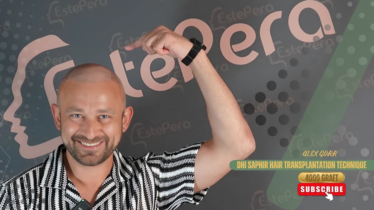 Hair Transplant Patient Interview at Estepera Hair Clinic | Real Experience in Istanbul