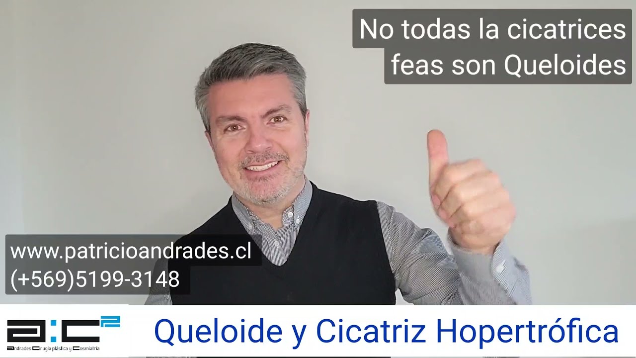 Queloide y Cicatriz Hipertr&oacute;fica