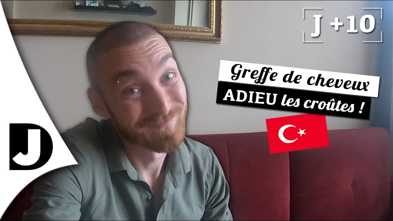 🇹🇷 [GREFFE de CHEVEUX J+10] Fini les CROÛTES ! 😃