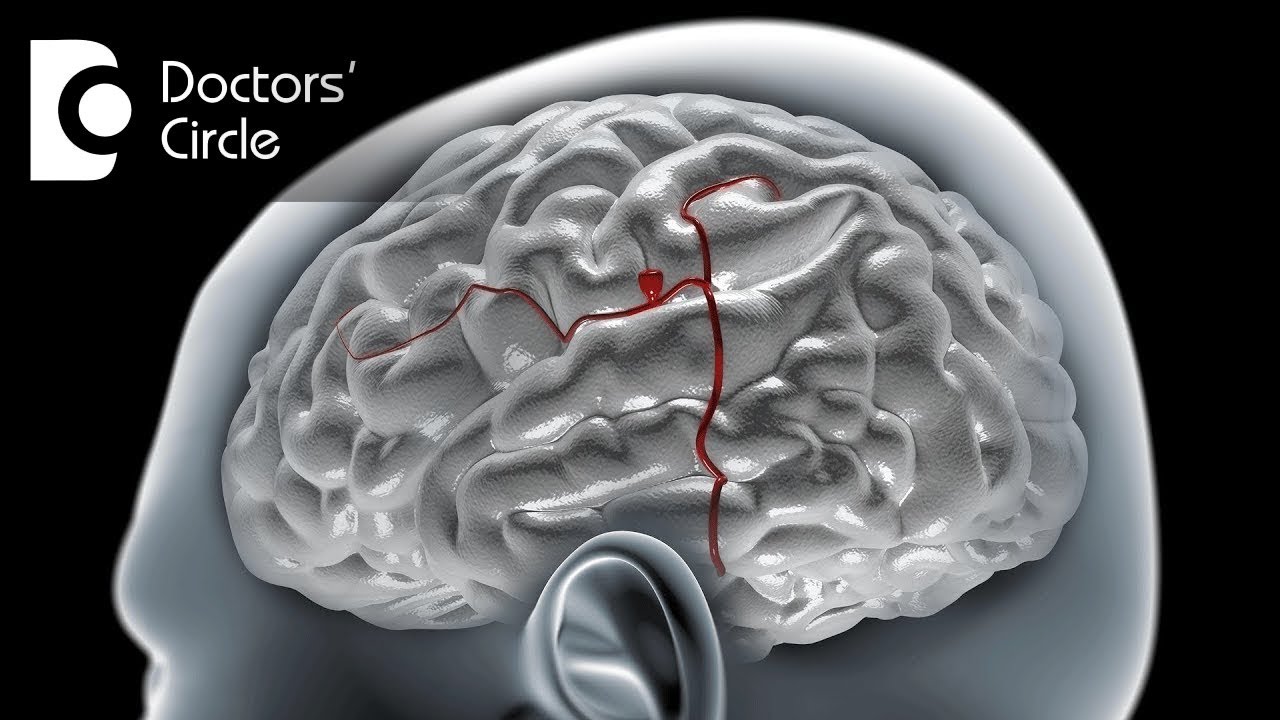 Can a ruptured Brain Aneurysm cause violent or aggressive behavior? - Dr. Tejus MN Rao