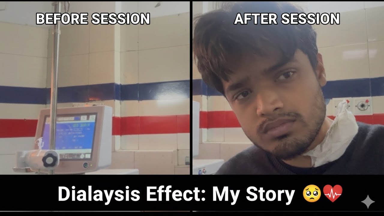 Post-Dialysis Effect is Real...