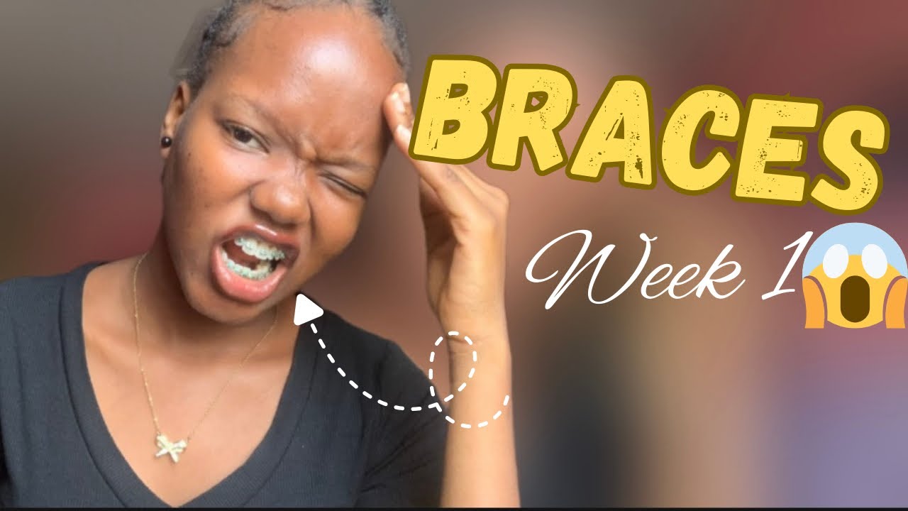 My First Week With Braces 😭 | Pain, Eating & What Nobody Told Me