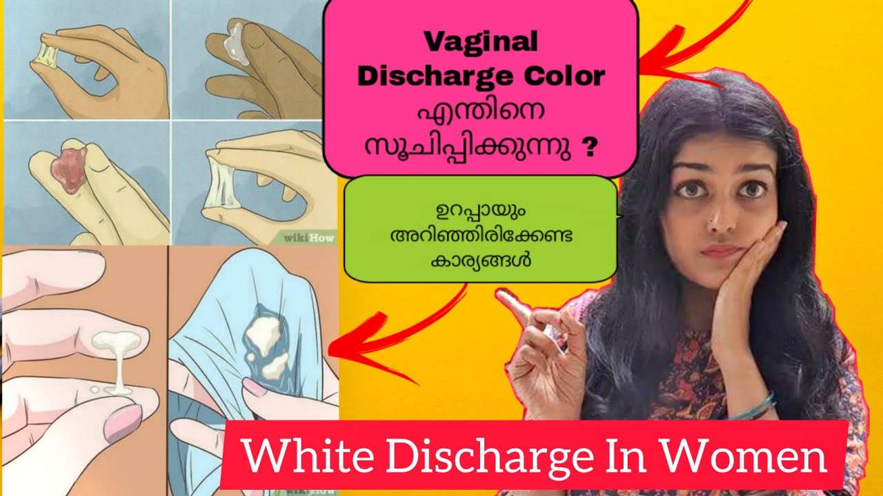 സ്ത്രീകളും പെൺകുട്ടികളും ശ്രദ്ധിക്കുക🔻|White Discharge കാരണങ്ങളും പരിഹാരങ്ങളും|Vaginal Care Part 3