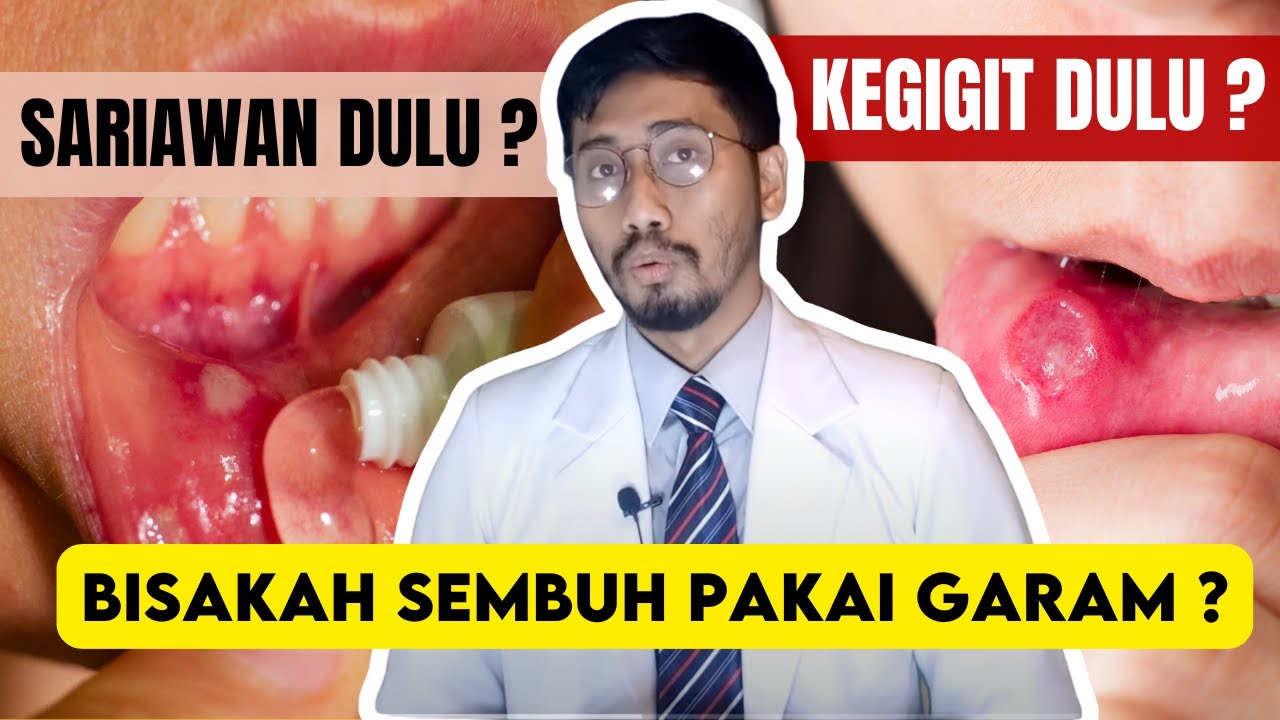Cara Mengatasi Sariawan, Benarkah garam bisa mengatasinya?