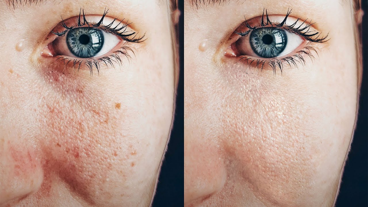 Быстрое и естественное лечение кожи с помощью Photoshop | Thuy Uyen