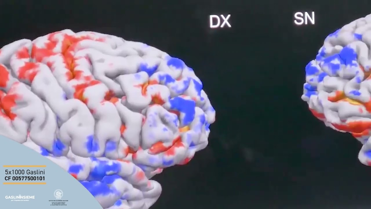 Al Gaslini grazie ai fondi 5x1000 il progetto di neuroimagining
