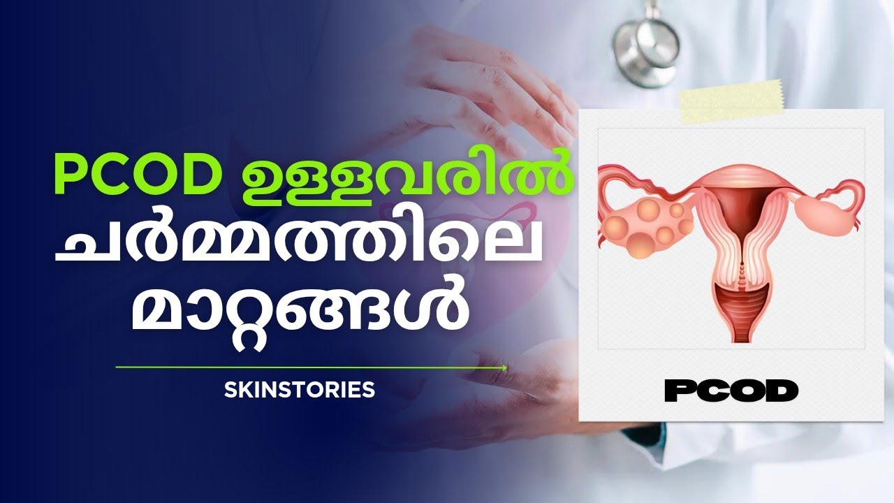 PCOD ഉള്ളവരിൽ ഉള്ള സ്കിൻ ചെയിഞ്ചസ് | Skin changes in people with PCOD | Skinstories |