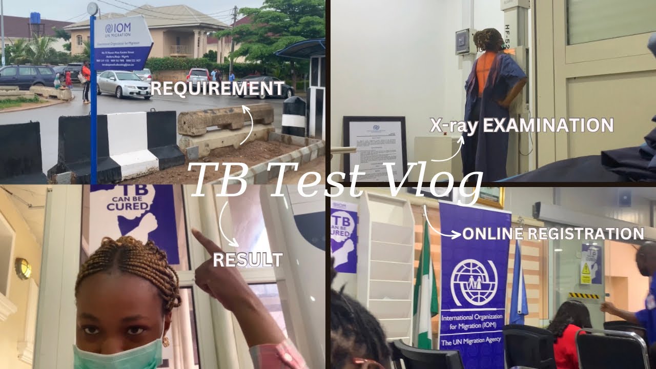 Step by Step Process: How to Book for TB Test for VISA, Requirements + Attending the IOM centre Vlog