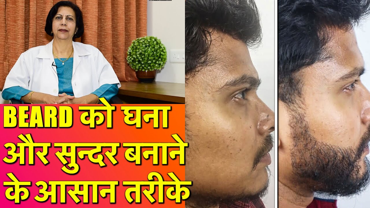 दाड़ी को घना और सुन्दर बनाने  के आसान तरीक़े || How To Get Thick Beard