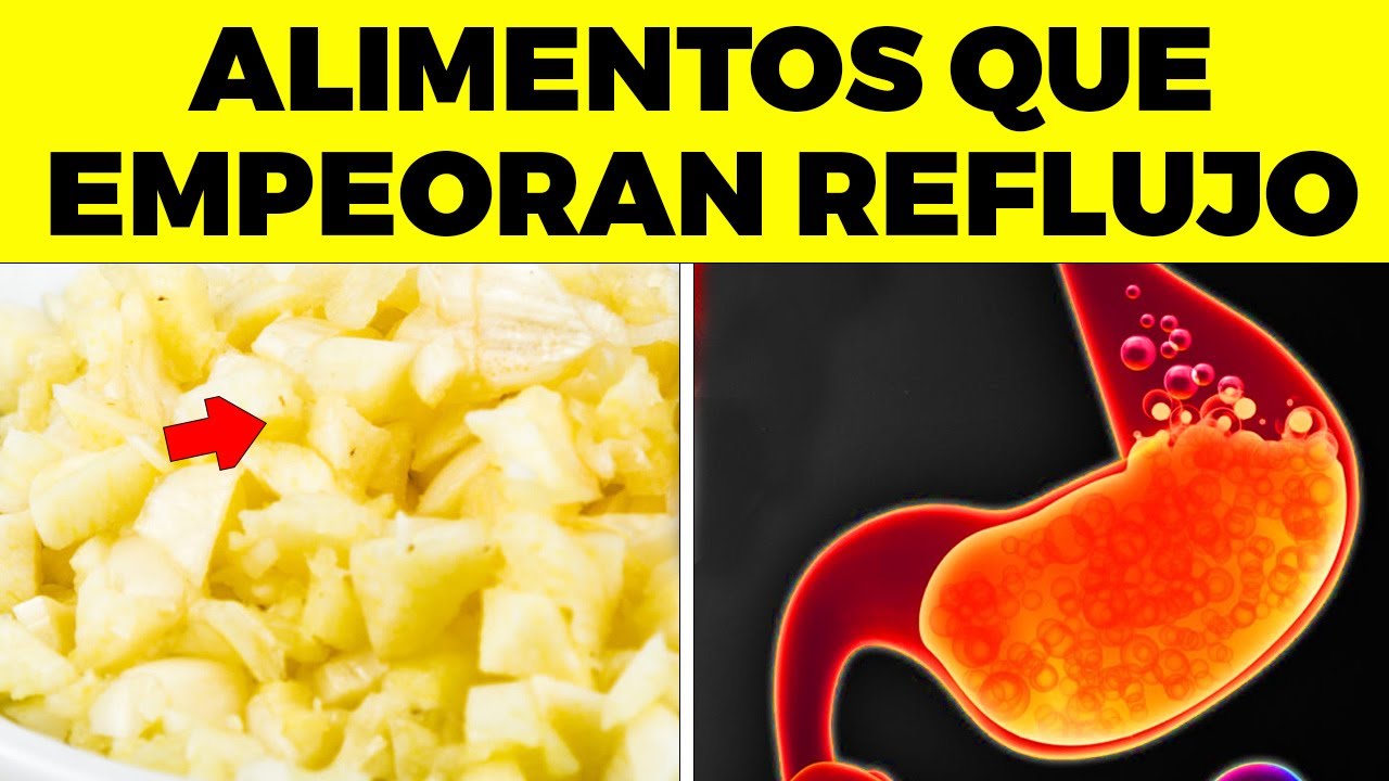 &iexcl;REVELADO!  10 ALIMENTOS que empeoran el REFLUJO GASTROESOFAGICO, no los comas