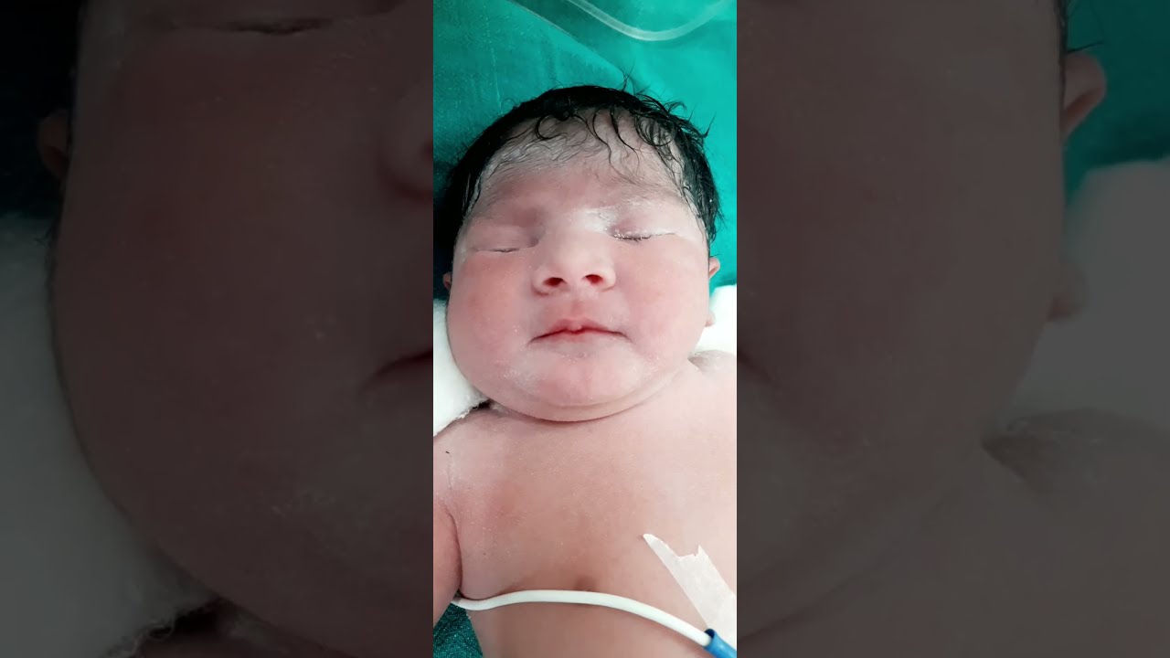 cute baby care icu baby care🥰🥰🥰🥰 @Nursinglifelinesuman 