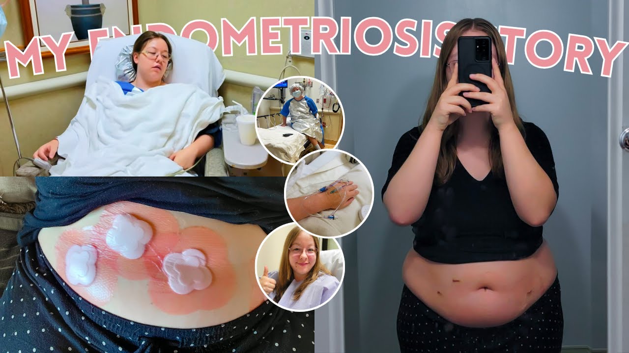 My Endometriosis Story (Symptoms, Surgeries, Diagnosis, Gas Lit, + Endometriosis Awareness Month)
