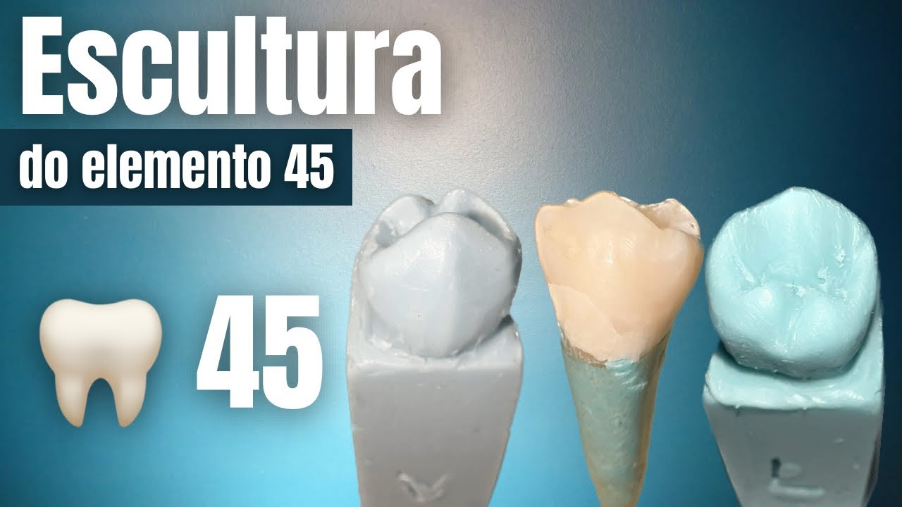 Escultura do dente 45