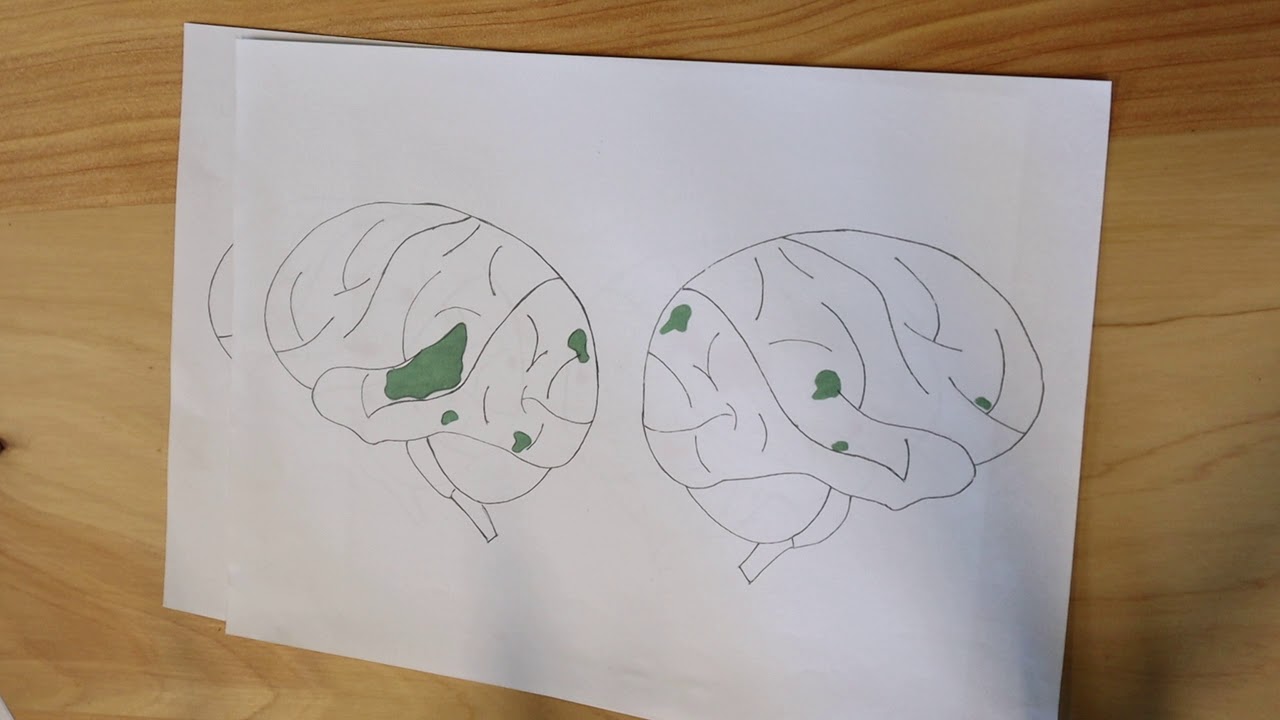 Why Kids Struggle With Reading and Writing Video 1