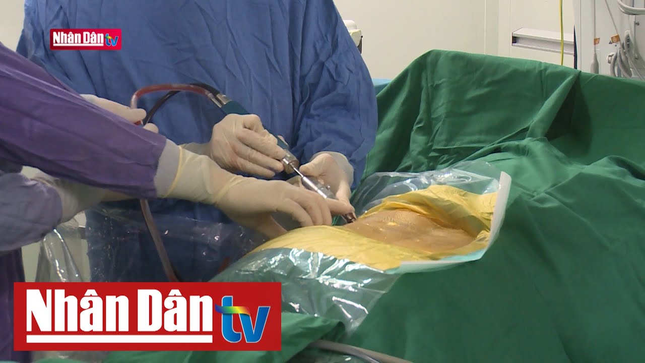 Những kỹ thuật mới trong ngành chấn thương chỉnh hình | Sống khỏe