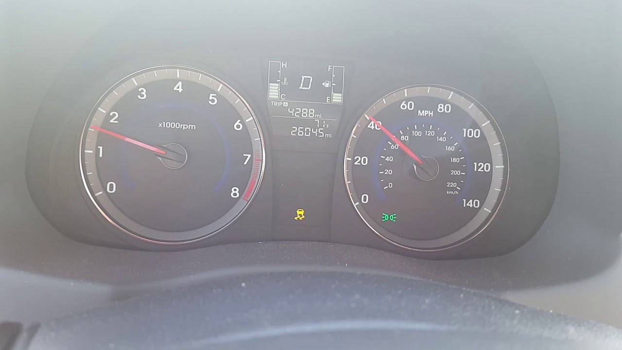 2016 Hyundai Accent issues #2 part 2