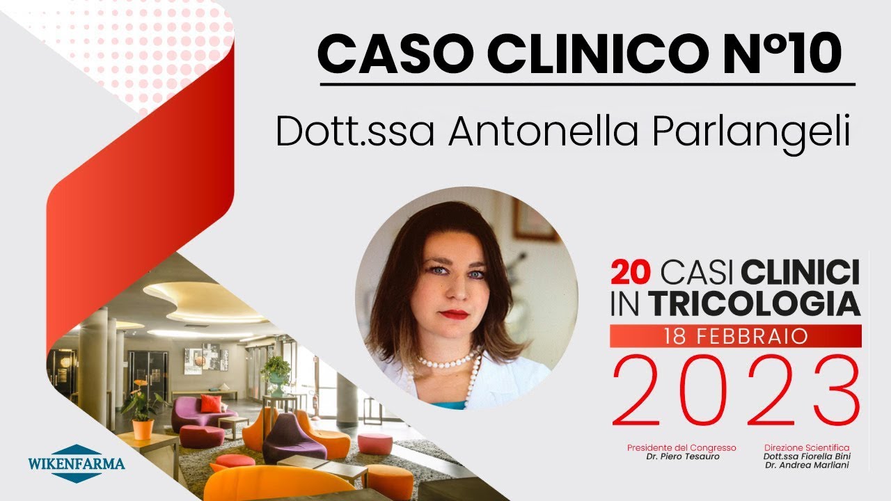 Dott.ssa Parlangeli: Alopecia areata o Lupus?