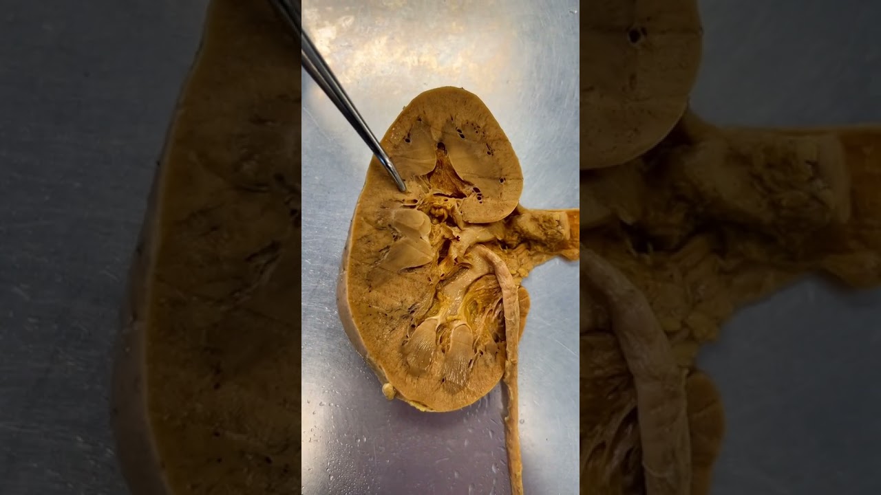 Hydration explained!