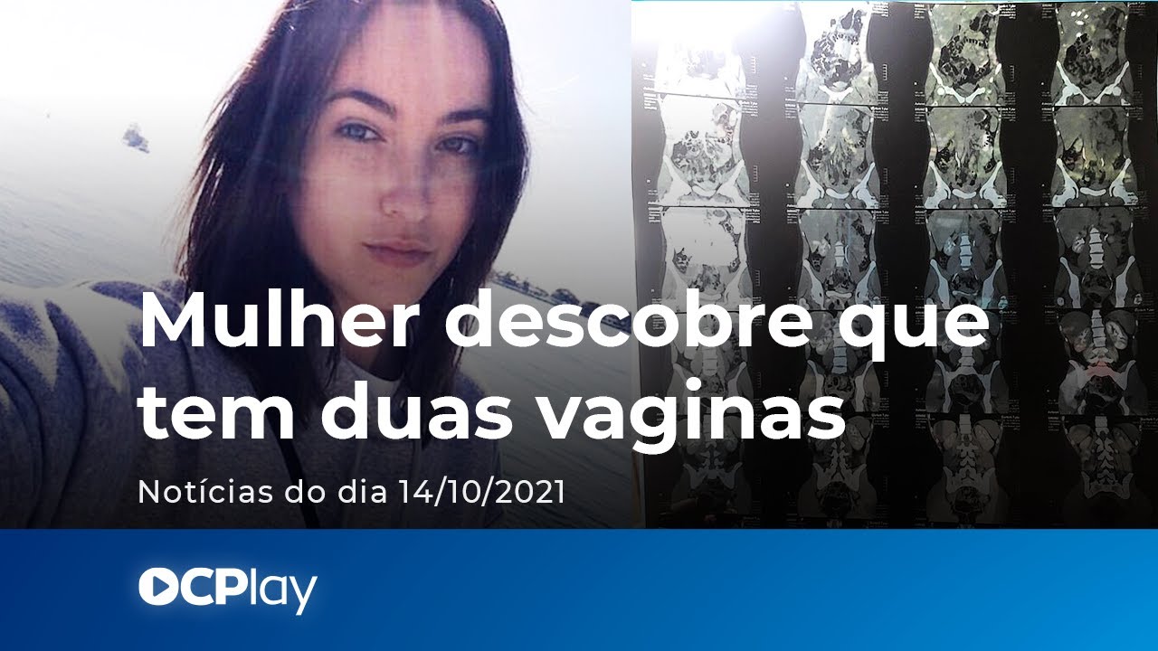 Mulher descobre que tem dois &oacute;rg&atilde;os genitais