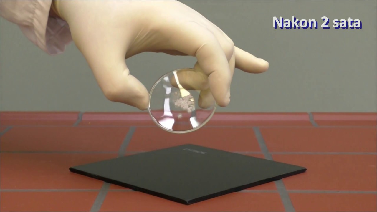 Natrij (Sodium)