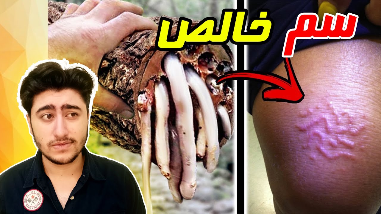🤔😮 سمی ترین وعجیب ترین درخت های روی کره ی زمین