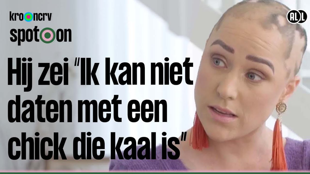 Door ALOPECIA heb ik GEEN HAAR #21 | Seizoen 6 | Spot On