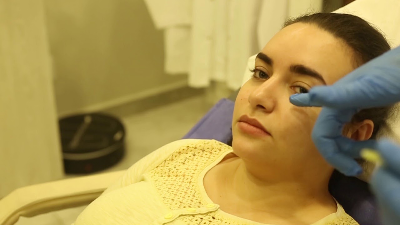 Meso Botox from Apriline