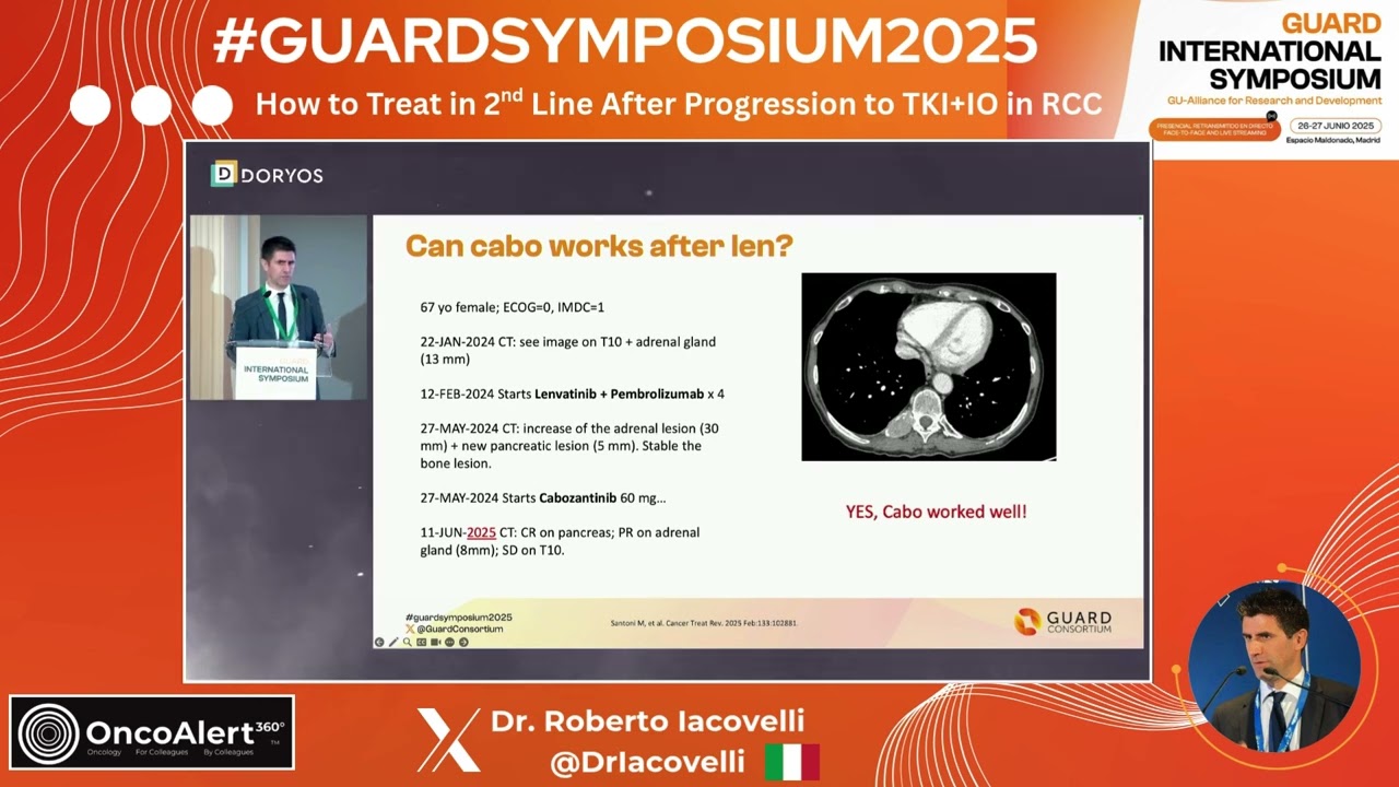 What&rsquo;s Next After TKI+IO in Kidney Cancer? Dr. Iacovelli Breaks It Down | GUARD Symposium 2025