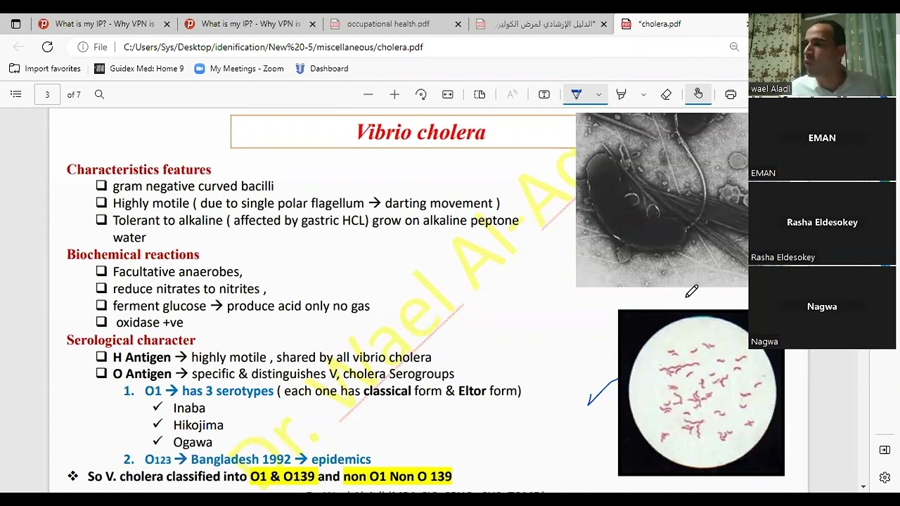 vibrio cholera