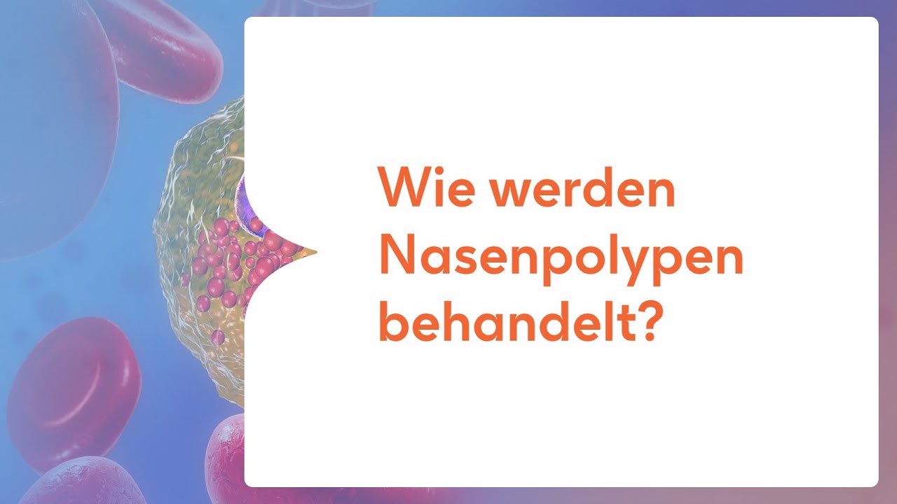 Wie werden Nasenpolypen behandelt?