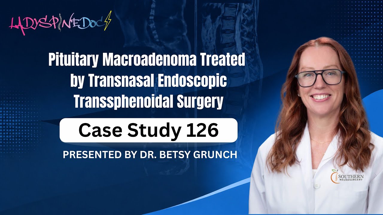 Case study 126 | Pituitary Macroadenoma treated by Transnasal Endoscopic Transsphenoidal Surgery