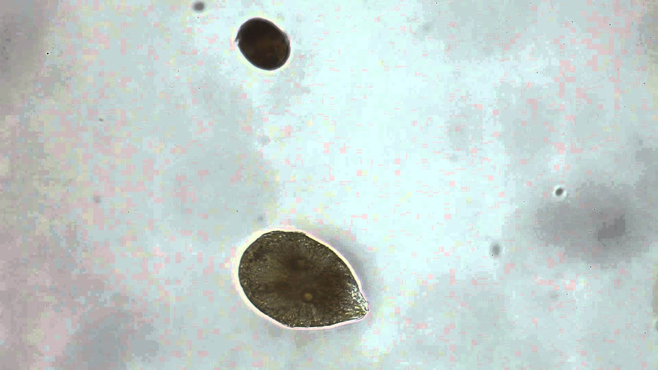 Ostreopsis y Coolia