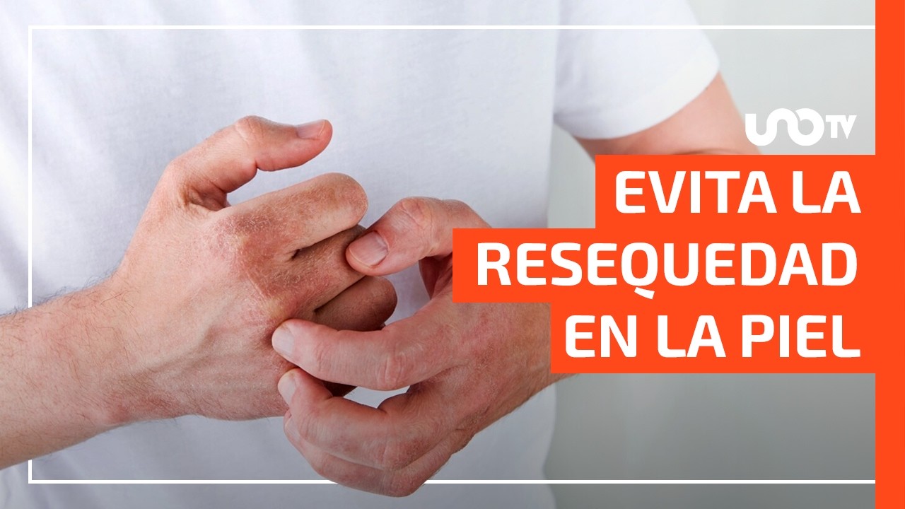 Resequedad de la piel, &iquest;por qu&eacute; se genera y c&oacute;mo evitarla?