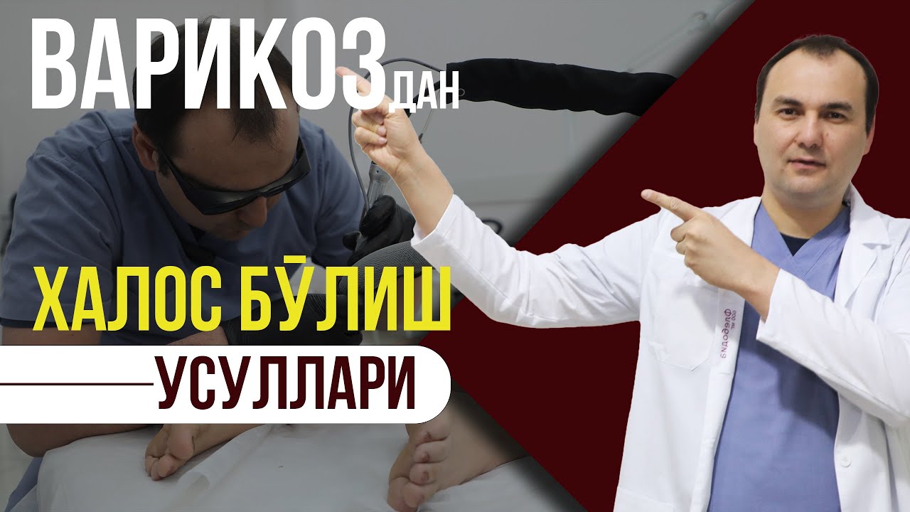 ❓ Варикоздан қандай қутулиш мумкин