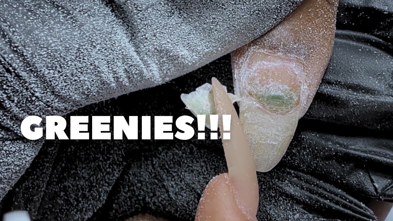 Greenies! What are they? What to do??