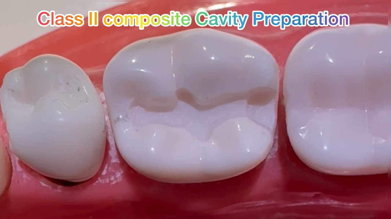 Class II composite cavity prep made simple  | Dr.Dentique-hub 