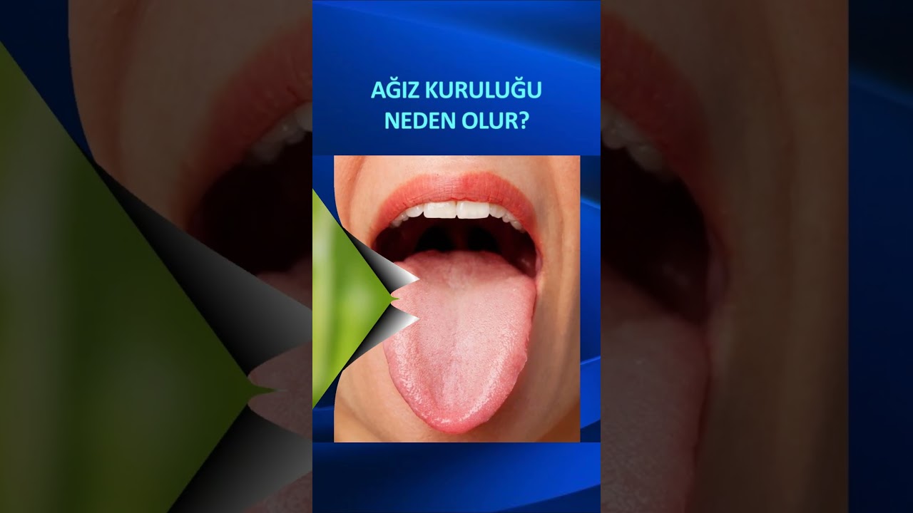 AĞIZ KURULUĞU NEDEN OLUR? #ağızkuruluğu #ağızkuruluğunedenolur #ağızdakuruma