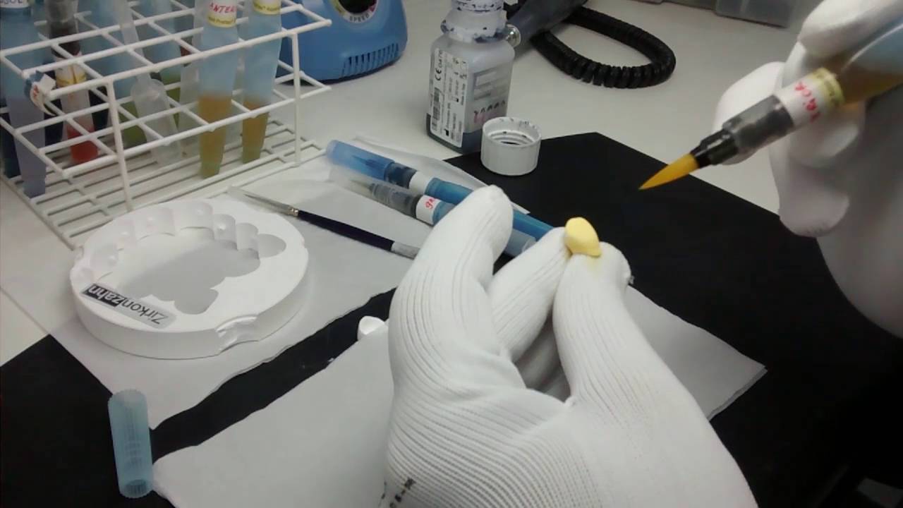 Pintura de Zircônia  Prettau anterior, talmax