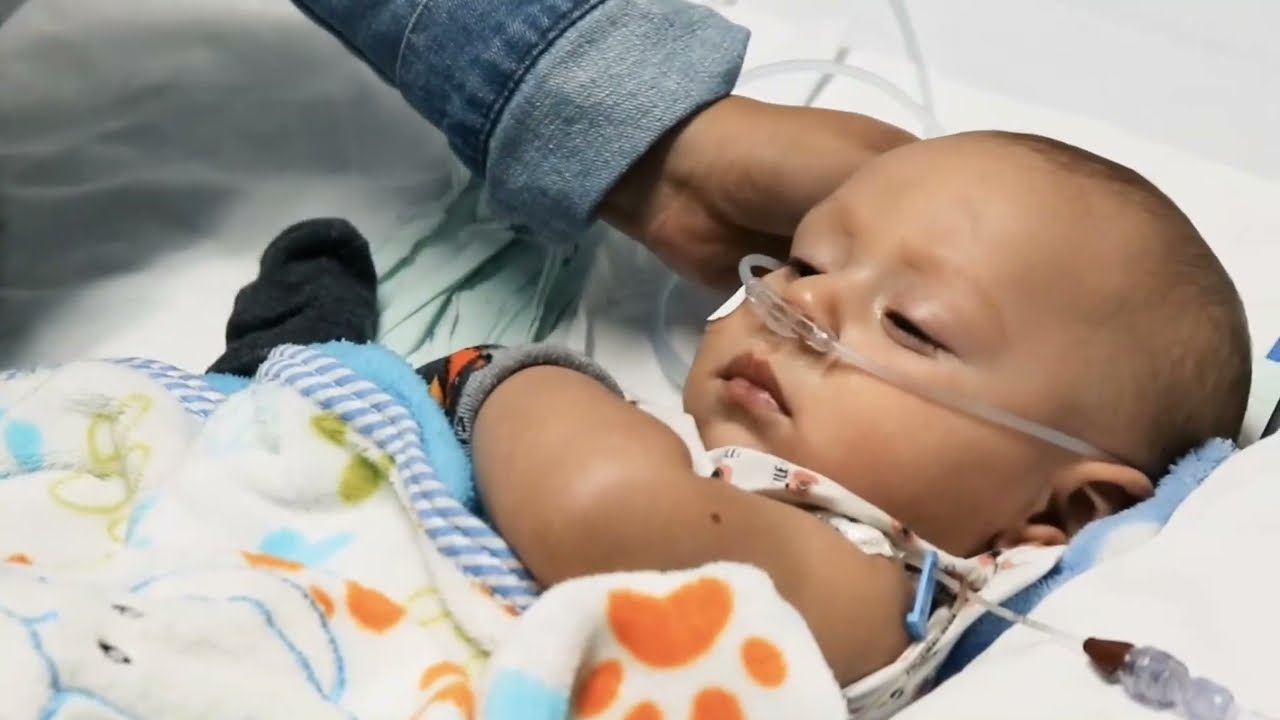 Enfermedad de Hirschsprung en niño - Caso Clinica Versalles