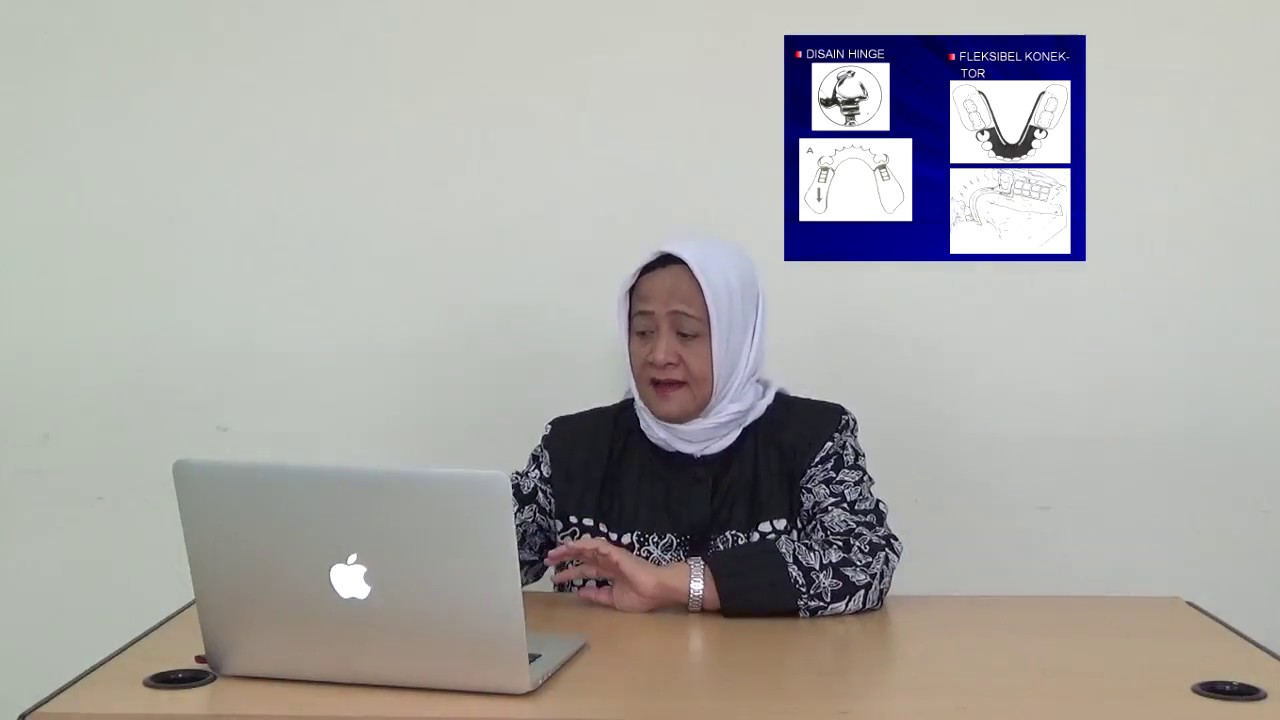 E-Learning FKG UA : Prinsip Desain GTSL Kennedy